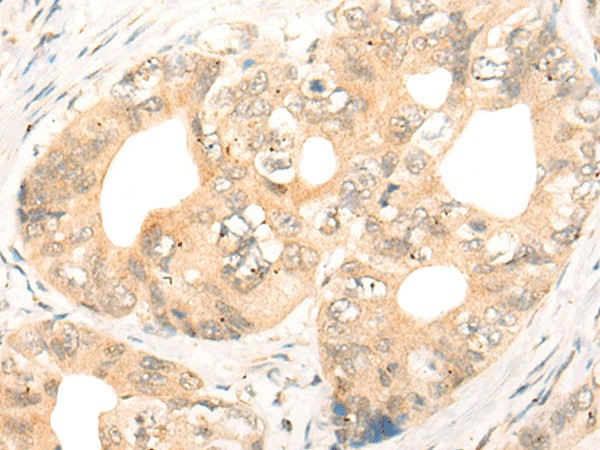 CD86 Polyclonal Antibody (E-AB-52526)
