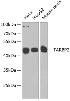 TARBP2 Polyclonal Antibody (E-AB-61766)