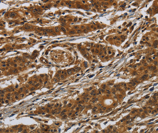 GATA5 Polyclonal Antibody (E-AB-12446)
