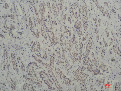 TBP Monoclonal Antibody (E-AB-22171)