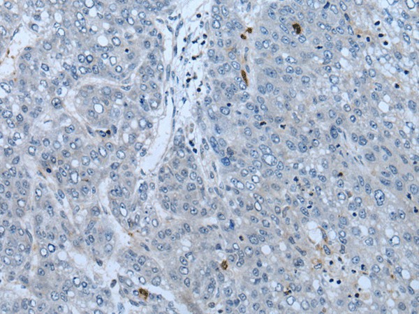 NF1 Polyclonal Antibody (E-AB-53528)