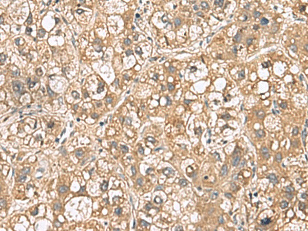 PTPRS Polyclonal Antibody (E-AB-19112)