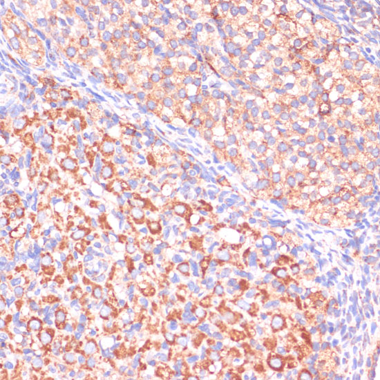 VHL Polyclonal Antibody (E-AB-65684)