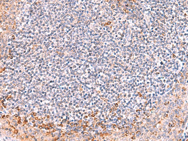 ITSN2 Polyclonal Antibody (E-AB-18120)