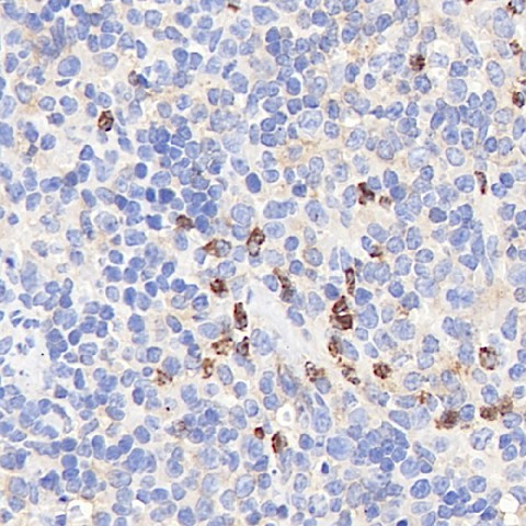 CYBB Polyclonal Antibody (E-AB-70273)