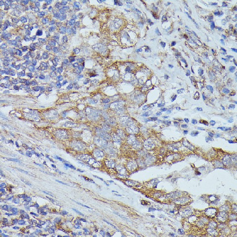 CTTN Polyclonal Antibody (E-AB-65184)