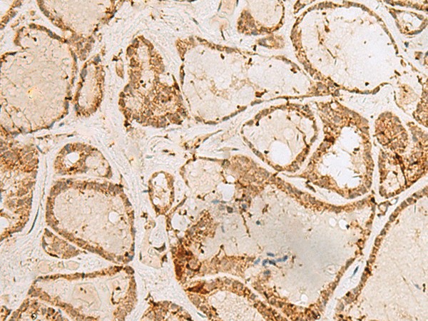 H3F3B Polyclonal Antibody (E-AB-52806)