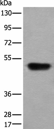 HNRNPH2 Polyclonal Antibody (E-AB-52276)