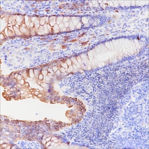Recombinant c-erbB-3/HER-3 Monoclonal Antibody (AN301516L)