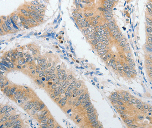 PIBF1 Polyclonal Antibody (E-AB-15826)