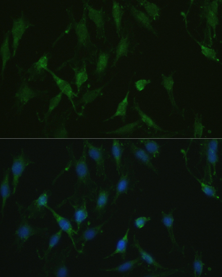 TRPV1 Polyclonal Antibody (E-AB-67999)