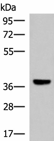 LRG1 Polyclonal Antibody (E-AB-52903)