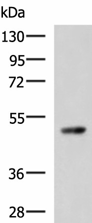 TP53 Polyclonal Antibody (E-AB-52130)