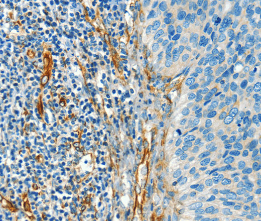 DIO2 Polyclonal Antibody (E-AB-13198)