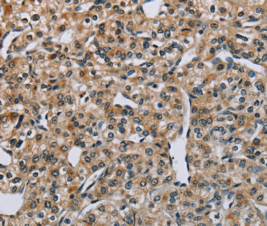 PNPT1 Polyclonal Antibody (E-AB-16726)