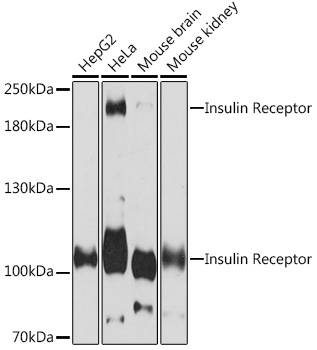 Insulin Receptor Polyclonal Antibody (E-AB-91652)