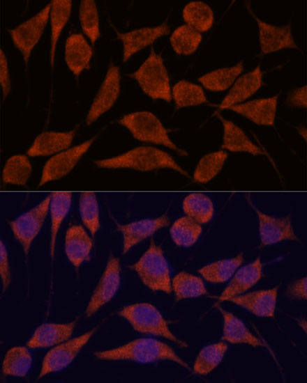 TRAPPC6A Polyclonal Antibody (E-AB-66702)