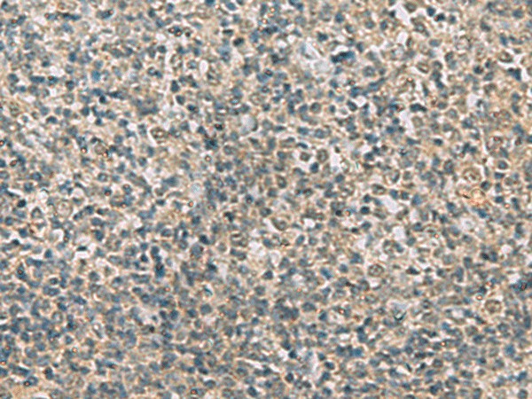 RAB3IP Polyclonal Antibody (E-AB-19195)