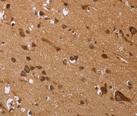EDN3 Polyclonal Antibody (E-AB-11199)