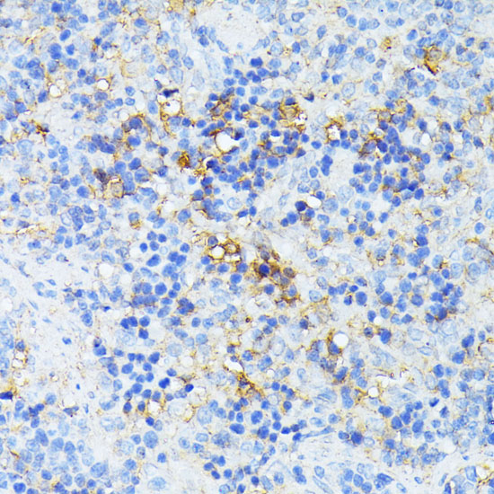 TP53I11 Polyclonal Antibody (E-AB-65972)
