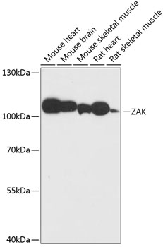 ZAK Polyclonal Antibody (E-AB-65019)