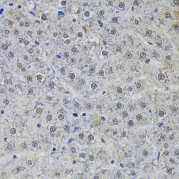 SNRPA Polyclonal Antibody (E-AB-61942)