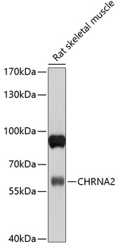 CHRNA2 Polyclonal Antibody (E-AB-90054)