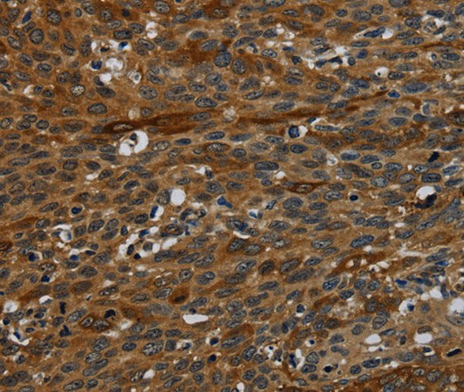 IVL Polyclonal Antibody (E-AB-16690)