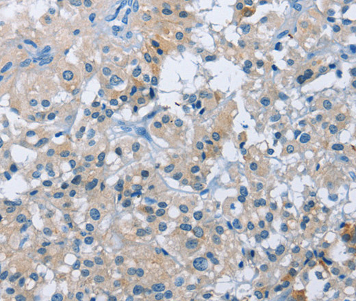 BTN2A2 Polyclonal Antibody (E-AB-11013)