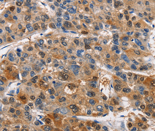 PIM1 Polyclonal Antibody (E-AB-10915)