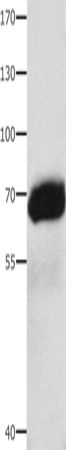 AFP Polyclonal Antibody (E-AB-13768)