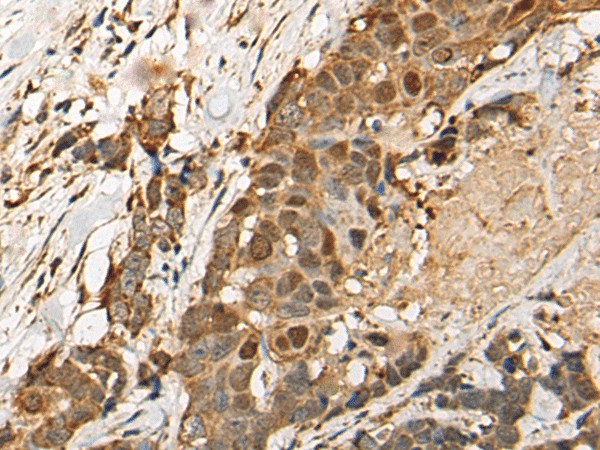 HEATR9 Polyclonal Antibody (E-AB-18557)
