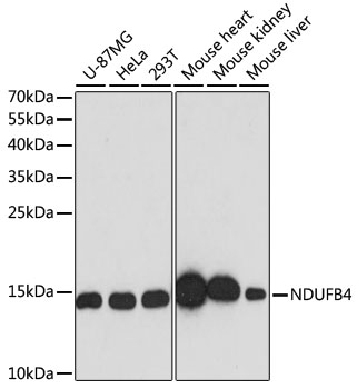 (KO Validated) NDUFB4 Polyclonal Antibody (E-AB-64835)