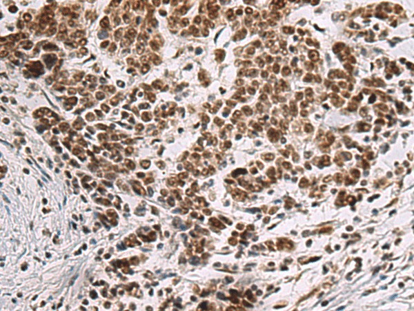 CREBBP Polyclonal Antibody (E-AB-19276)