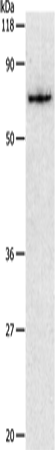 PKM Polyclonal Antibody (E-AB-13771)