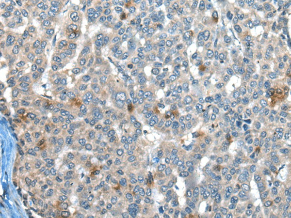 CAPN3 Polyclonal Antibody (E-AB-52137)