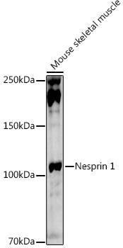 Nesprin 1 Polyclonal Antibody (E-AB-92207)