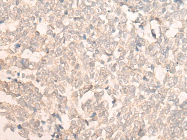 FAN1 Polyclonal Antibody (E-AB-17946)