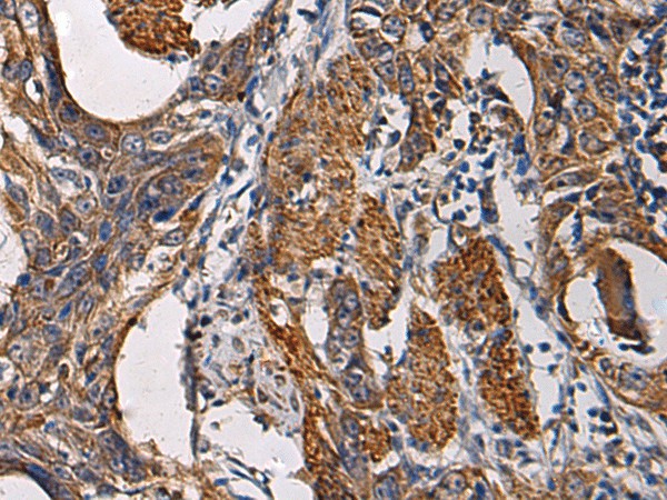 SSH3 Polyclonal Antibody (E-AB-19236)