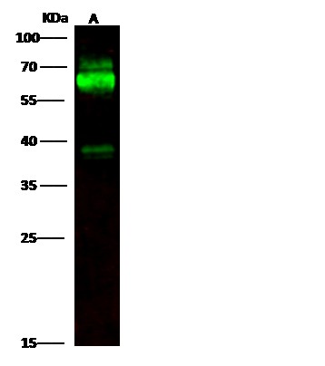Recombinant TH/Tyrosine Hydroxylase Monoclonal Antibody (AN300167P)