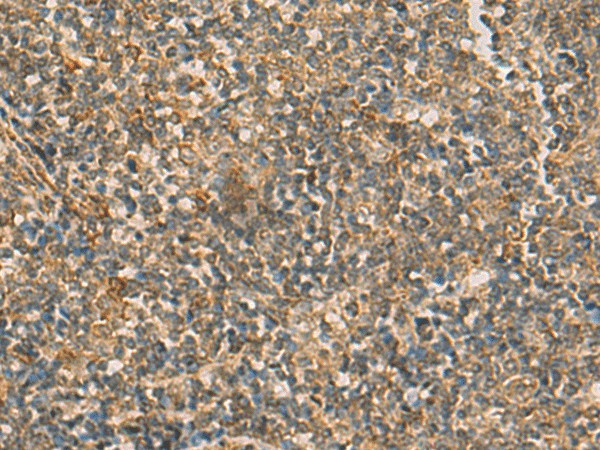 IFT22 Polyclonal Antibody (E-AB-52835)