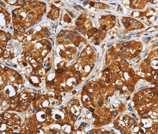 GGCX Polyclonal Antibody (E-AB-15065)