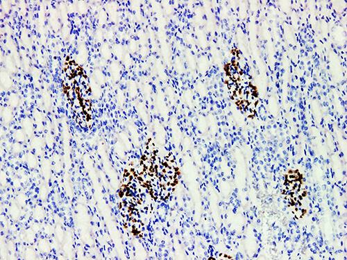 WT1 Monoclonal Antibody (ELAB6533-M)