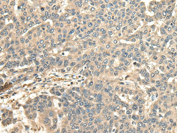 CCDC113 Polyclonal Antibody (E-AB-18589)