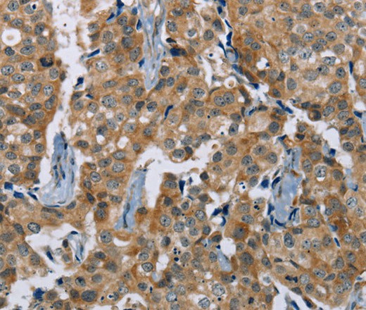 PLXNA4 Polyclonal Antibody (E-AB-16722)