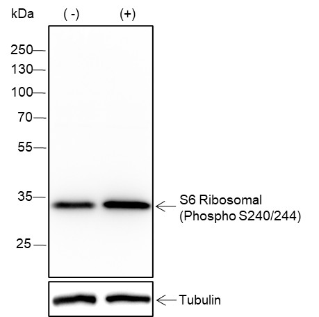 Recombinant Phospho-S6 Ribosomal Protein (Ser240, 244) Monoclonal Antibody (AN302078L)