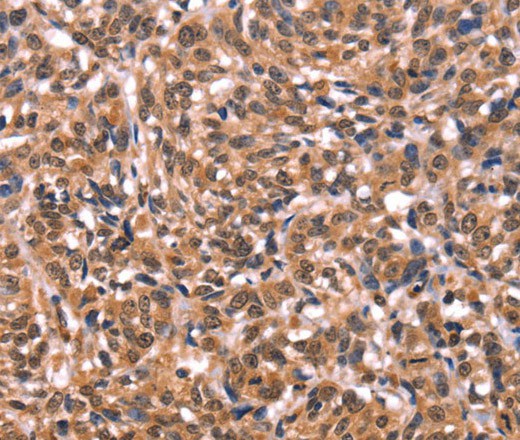 ESRRB Polyclonal Antibody (E-AB-16414)
