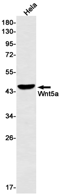 Recombinant Wnt5a Monoclonal Antibody (E-AB-81621)