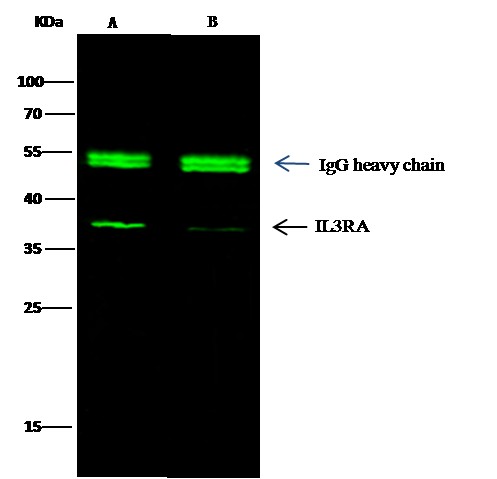 Recombinant IL3RA/CD123 Monoclonal Antibody (AN300195P)