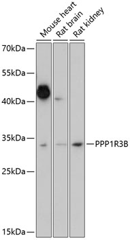 PPP1R3B Polyclonal Antibody (E-AB-91006)